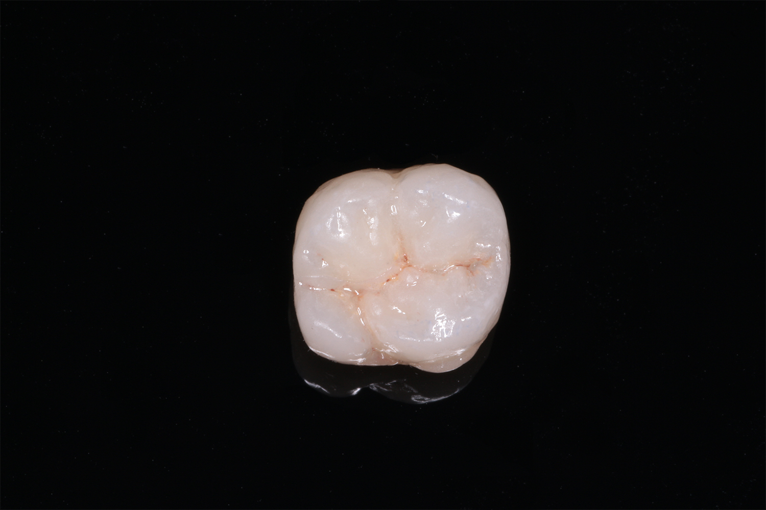 lucrare dentala asimetric